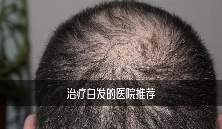 治疗白发的医院推荐哪家比较好一点北京中科